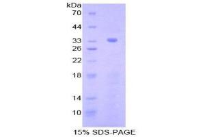 SDS-PAGE (SDS) image for Nucleoredoxin (NXN) (AA 167-435) protein (His tag) (ABIN2126177)