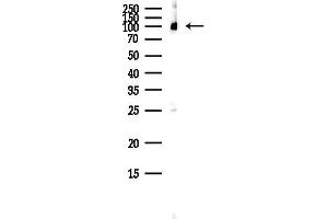 Western blot analysis of lysates from HepG2 cells(heat-shock,45 min treatment), using ABCF1 Antibody at 1/1000 dilution.