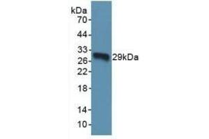 Detection of Recombinant TOR1A, Human using Polyclonal Antibody to Torsin 1A (TOR1A)
