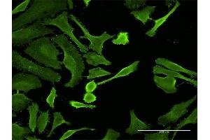 Immunofluorescence of monoclonal antibody to CTLA4 on HeLa cell.