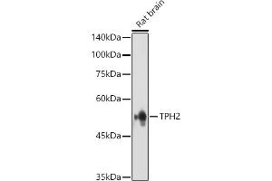 Western blot analysis of extracts of various cell lines, using TET3 antibody (ABIN6133174, ABIN6149021, ABIN6149023 and ABIN6223527) at 1:1000 dilution. (Tryptophan Hydroxylase 2 anticorps  (AA 1-170))