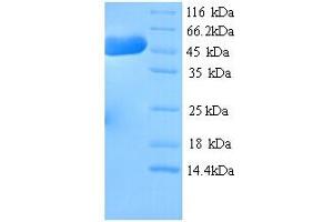 SDS-PAGE (SDS) image for Hydroxymethylglutaryl-Coa Synthase (HMCS1) (AA 1-520), (full length) protein (His tag) (ABIN5714418) (HMCS1 Protein (AA 1-520, full length) (His tag))