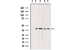 Western blot analysis of extracts from various samples, using TOM40 antibody. (TOMM40 anticorps  (Internal Region))