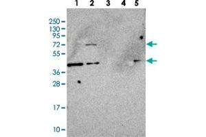 Western blot analysis of MOCS1 polyclonal antibody .