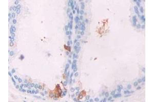 DAB staining on IHC-P; Samples: Human Prostate Tissue (GREM1 anticorps  (AA 26-184))