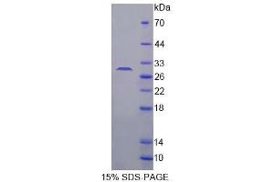 SDS-PAGE analysis of Mouse C/EBP delta Protein. (CEBPD Protéine)