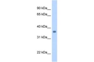 Western Blotting (WB) image for anti-Sarcoglycan, gamma (35kDa Dystrophin-Associated Glycoprotein) (SGCG) antibody (ABIN2462796) (SGCG anticorps)