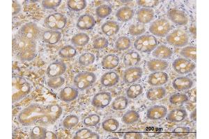 Immunoperoxidase of monoclonal antibody to ERO1L on formalin-fixed paraffin-embedded human small Intestine.