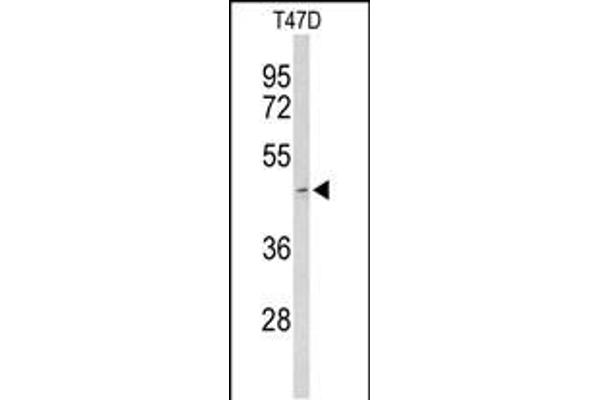 Acrosin antibody  (AA 99-127)