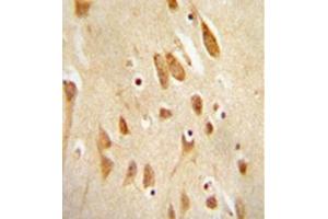 Immunohistochemistry analysis in formalin fixed and paraffin embedded human brain tissue reacted with MAPK8 / JNK1 Antibody (Thr183/Tyr185) followed which was peroxidase conjugated to the secondary antibody and followed by DAB staining. (JNK anticorps  (AA 162-199))