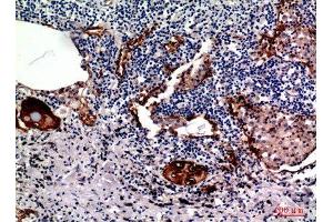 Immunohistochemistry (IHC) analysis of paraffin-embedded Human Lung, antibody was diluted at 1:100. (MUC1 anticorps  (Internal Region))