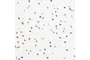 Immunohistochemistry of paraffin-embedded rat brain using ZEB2 Rabbit pAb (ABIN6131480, ABIN6150424, ABIN6150425 and ABIN6221369) at dilution of 1:100 (40x lens).