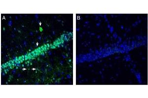 Expression of Neuromedin U Receptor 2 in rat hippocampus.