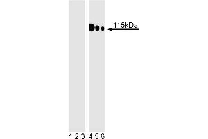 Western blot analysis of TBK1 (pS172) fusion protein. (TBK1 anticorps  (pSer172))