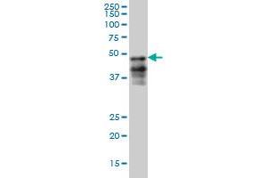 FOXA2 monoclonal antibody (M05), clone 6G9 Western Blot analysis of FOXA2 expression in HepG2 . (FOXA2 anticorps  (AA 363-457))