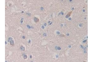 Detection of SEMA3A in Human Cerebrum Tissue using Polyclonal Antibody to Semaphorin 3A (SEMA3A)
