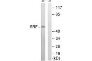 Western blot analysis of extracts from Jurkat cells, treated with insulin 0. (SRF anticorps  (AA 41-90))