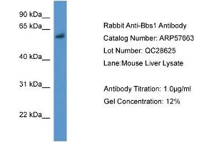 WB Suggested Anti-Bbs1  Antibody Titration: 0. (BBS1 anticorps  (N-Term))