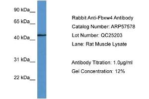 WB Suggested Anti-Fbxw4  Antibody Titration: 0. (FBXW4 anticorps  (C-Term))