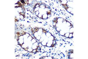 Immunohistochemistry of paraffin-embedded human colon using Peroxiredoxin 3 (PRDX3) (PRDX3) Rabbit mAb (ABIN7269237) at dilution of 1:100 (40x lens). (Peroxiredoxin 3 anticorps)