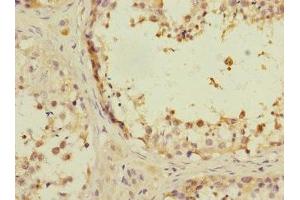 Immunohistochemistry of paraffin-embedded human testis tissue using ABIN7144208 at dilution of 1:100 (ANKS1B anticorps  (AA 999-1248))