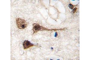 IHC analysis of FFPE human brain tissue stained with MEF2C antibody