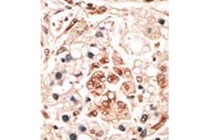 Image no. 2 for anti-Hippocalcin (HPCA) (N-Term) antibody (ABIN357112) (Hippocalcin anticorps  (N-Term))