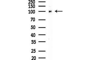 anti-N(alpha)-Acetyltransferase 15, NatA Auxiliary Subunit (NAA15) (Internal Region) antibody