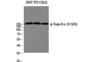 Western Blot (WB) analysis of 293T 3T3 COLO205 using p-Topo IIalpha (S1525) antibody. (Topo IIalpha (pSer1525) anticorps)