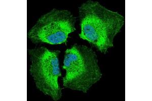 Immunocytochemistry (ICC) image for anti-Phosphoinositide-3-Kinase, Catalytic, alpha Polypeptide (PIK3CA) antibody (ABIN1844691)