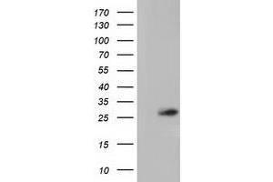 Western Blotting (WB) image for anti-OTU Domain, Ubiquitin Aldehyde Binding 2 (OTUB2) antibody (ABIN1499940) (OTUB2 anticorps)