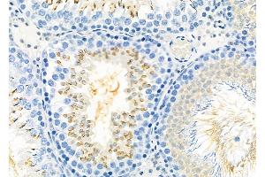 ABIN6260299 and ABIN6277920 at 1/100 staining Rat testis tissue by IHC-P. (IBSP anticorps  (Internal Region))