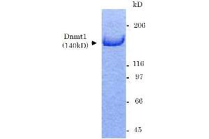 SDS-PAGE (SDS) image for DNA (Cytosine-5)-Methyltransferase 1 (DNMT1) (Active) protein (ABIN2452167)