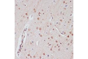 Immunohistochemistry of paraffin-embedded human lymph node using CREB1 antibody (ABIN7266053) at dilution of 1:100 (40x lens).