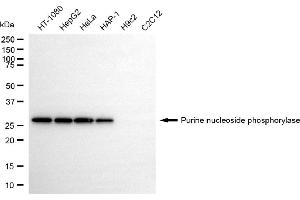 Western blotting analysis using purine nucleoside phosphorylase antibody (ABIN7800067).