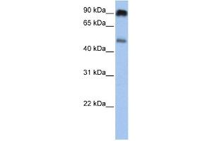WB Suggested Anti-SLC45A2 Antibody Titration:  0.
