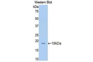 Western Blotting (WB) image for anti-Protein C Receptor, Endothelial (PROCR) (AA 32-167) antibody (ABIN1172003) (PROCR anticorps  (AA 32-167))