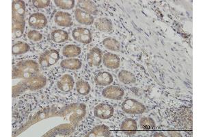 Immunoperoxidase of monoclonal antibody to NMI on formalin-fixed paraffin-embedded human small Intestine. (NMI anticorps  (AA 1-100))