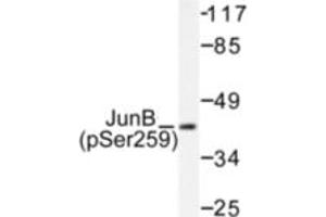 Image no. 1 for anti-Jun B Proto-Oncogene (JUNB) (pSer259) antibody (ABIN318057) (JunB anticorps  (pSer259))