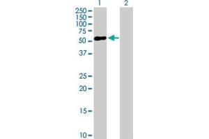 Western Blot analysis of ZNF436 expression in transfected 293T cell line by ZNF436 MaxPab polyclonal antibody. (ZNF436 anticorps  (AA 1-470))