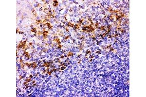 IHC-P: Integrin beta 1 antibody testing of human tonsil tissue (ITGB1 anticorps  (AA 527-728))