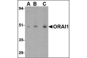 Western blot analysis of ORAI1 in human ovary tissue lysate with this product at (A) 0.