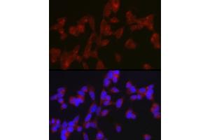 Immunofluorescence analysis of SH-SY5Y cells using A Rabbit pAb (ABIN7265712) at dilution of 1:150 (40x lens). (ATG9A anticorps  (AA 180-290))