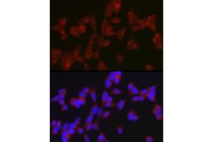 Immunofluorescence analysis of SH-SY5Y cells using A Rabbit pAb (ABIN7265712) at dilution of 1:150 (40x lens).