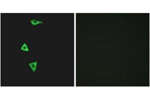 Immunofluorescence analysis of LOVO cells, using BDKRB1 Antibody.