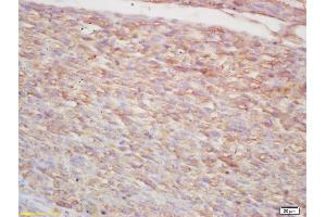 Formalin-fixed and paraffin embedded mouse embryo labeled with Rabbit Anti p38MAPK/MAPK14/p38Alpha Polyclonal Antibody, Unconjugated (ABIN671241) at 1:200 followed by conjugation to the secondary antibody and DAB staining