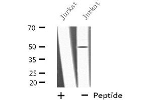 Western blot analysis of extracts from Jurkat cells, using LRP11 antibody. (LRP11 anticorps  (Internal Region))