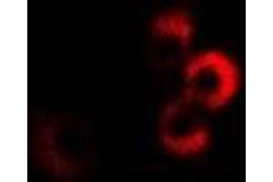 Immunofluorescent analysis of CPT2 staining in MCF7 cells.