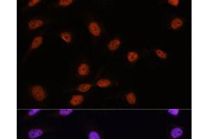 Immunofluorescence analysis of U-2 OS cells using SRSF7 Polyclonal Antibody at dilution of 1:100. (SFRS7 anticorps)