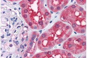 Human Kidney: Formalin-Fixed, Paraffin-Embedded (FFPE)